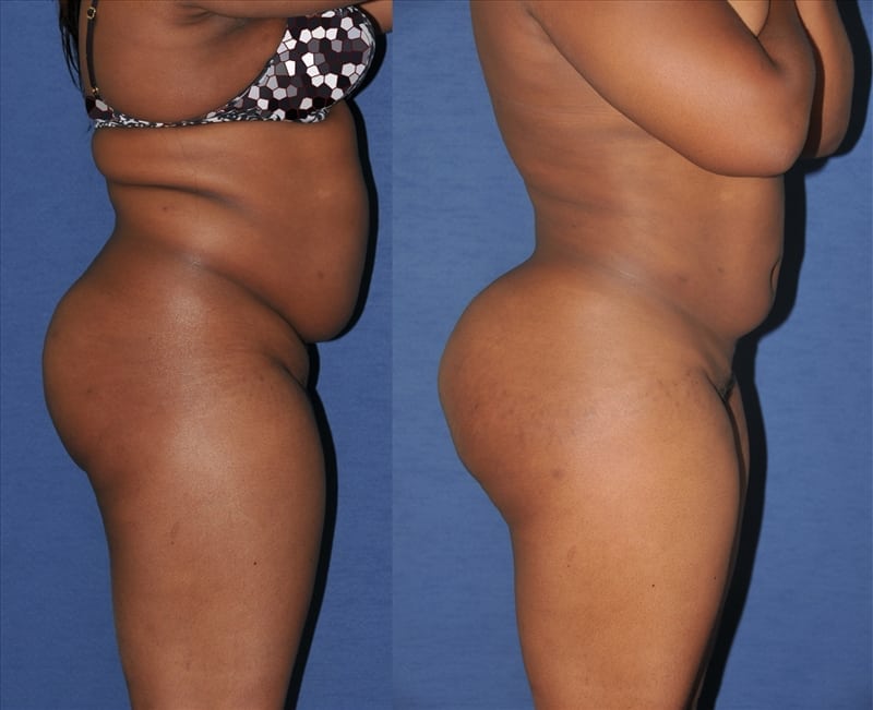Before and After Image
