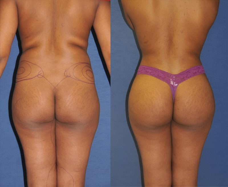 Before and After Image