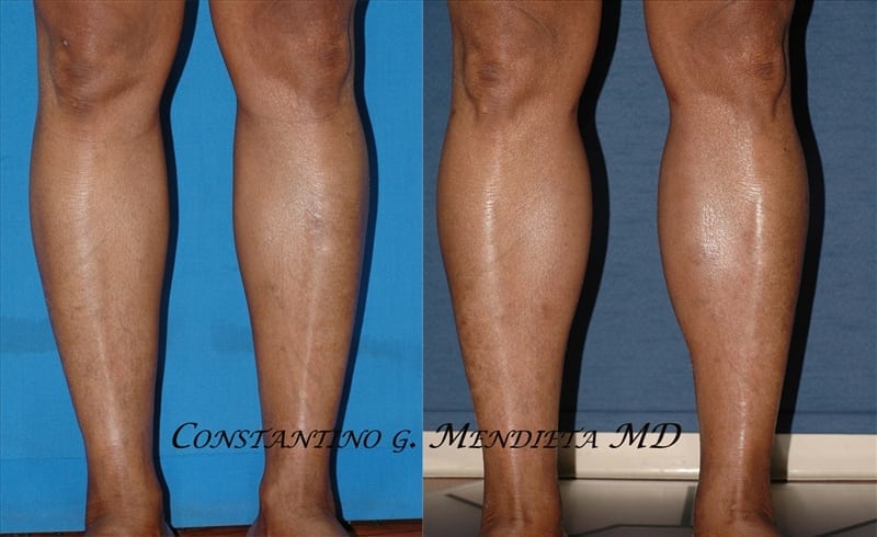 Before and After Image