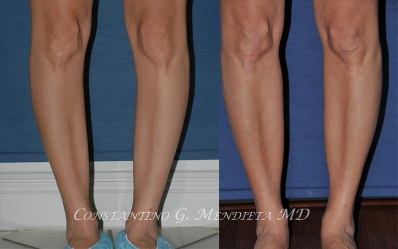 Before and After Image