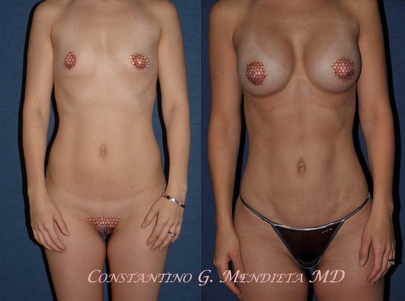 Before and After Image