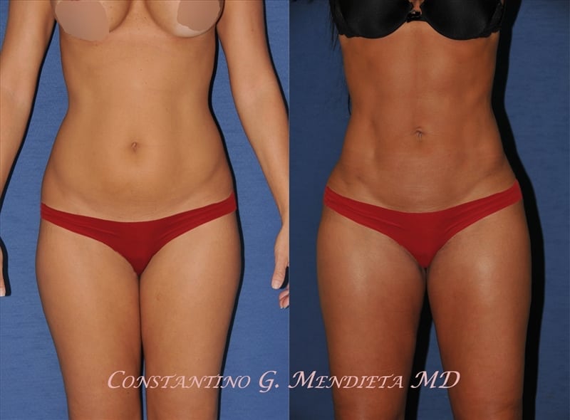 Before and After Image