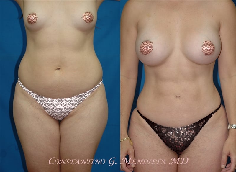 Before and After Image