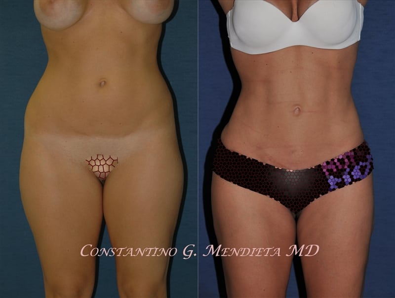 Before and After Image