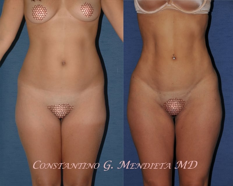 Before and After Image