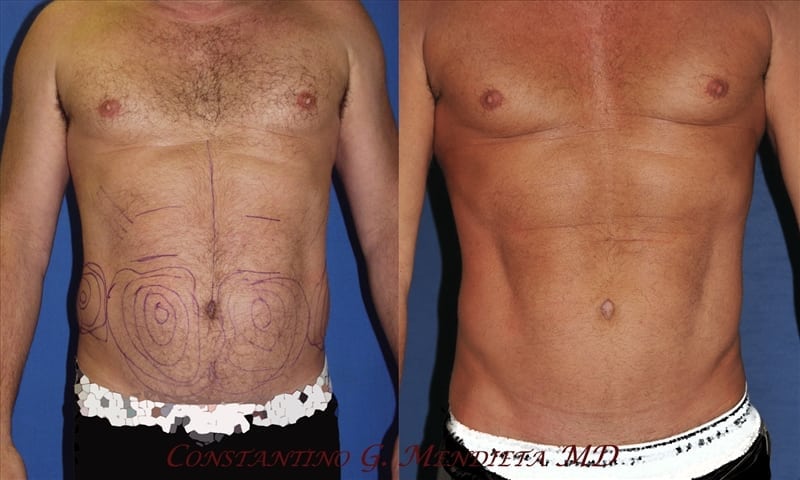 Before and After Image