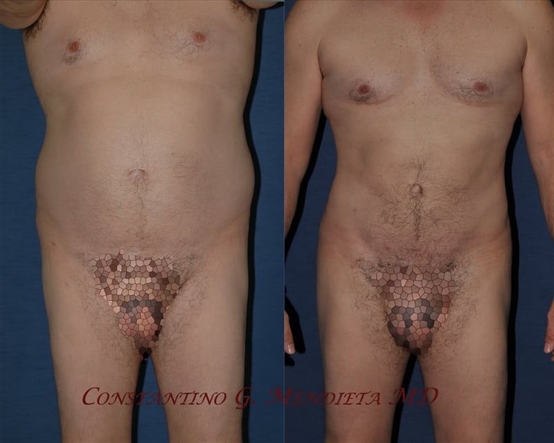 Before and After Image