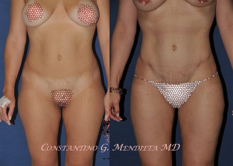 Before and After Image
