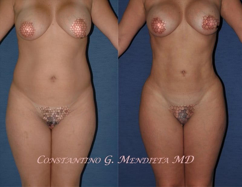 Before and After Image