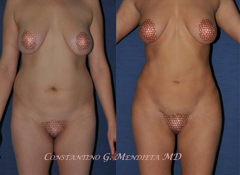 Before and After Image