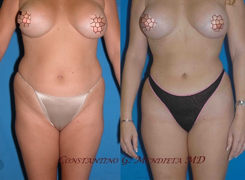 Before and After Image