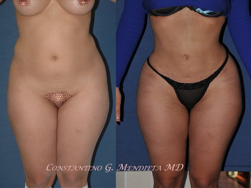 Before and After Image