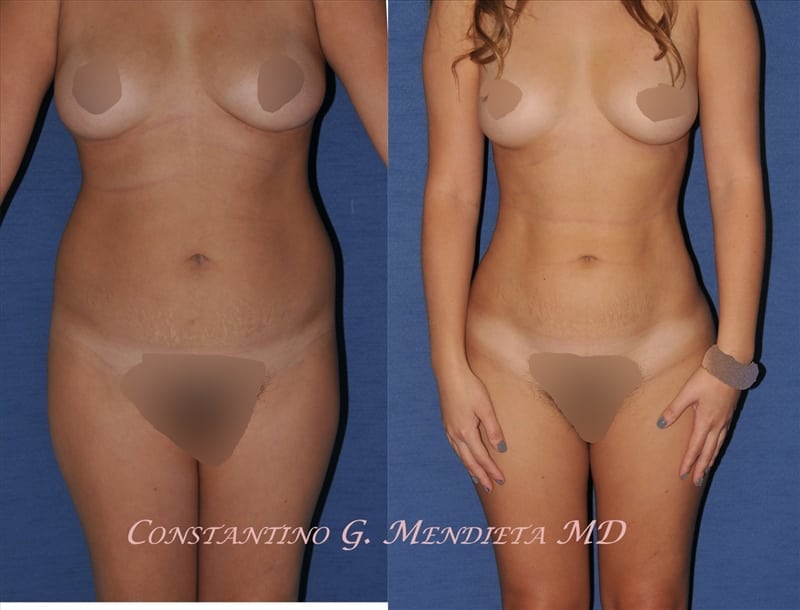 Before and After Image