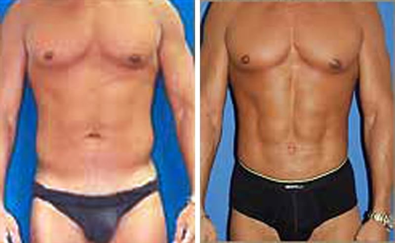 Before and After Image