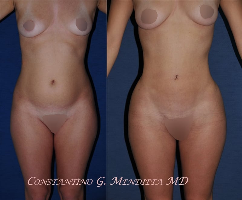 Before and After Image