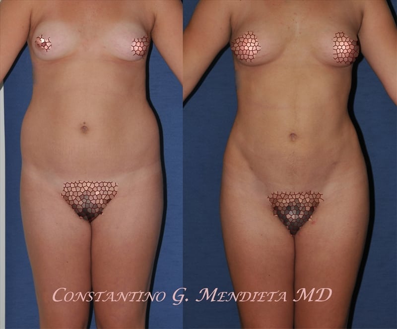 Before and After Image