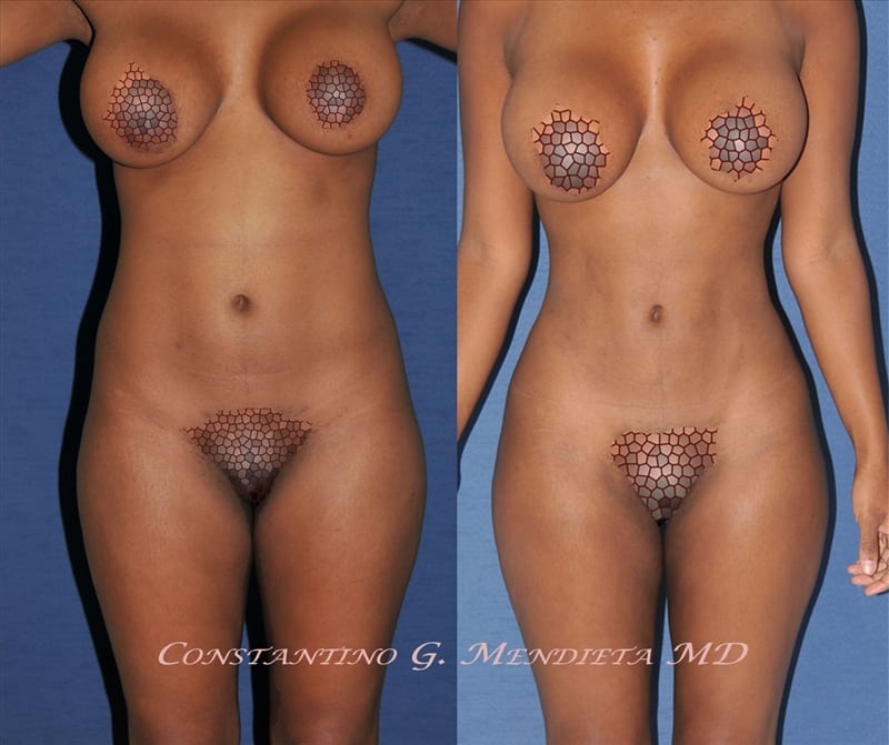 Before and After Image