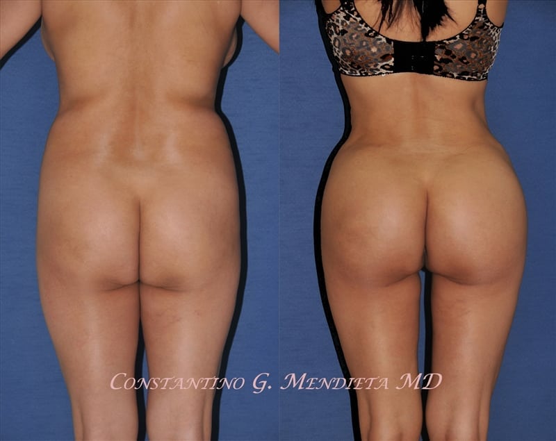 Before and After Image