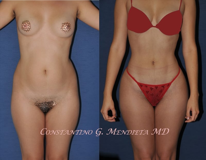 Before and After Image