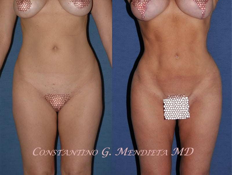 Before and After Image