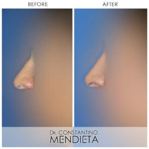 Before and After Image