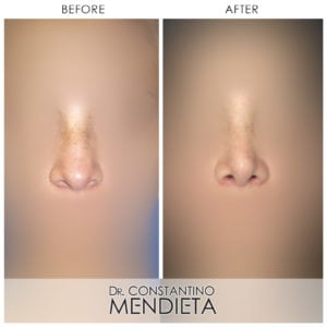 Before and After Image