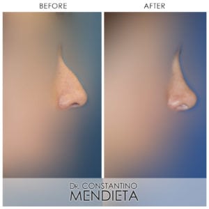 Before and After Image