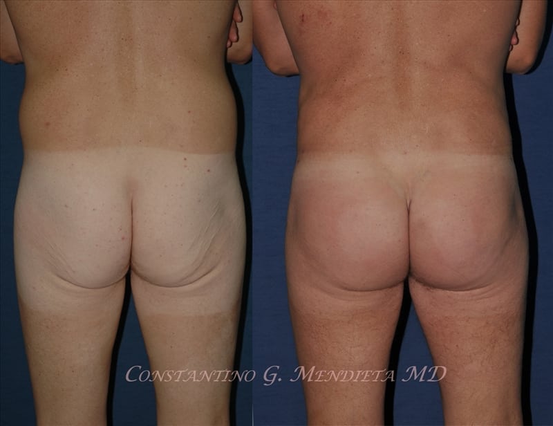 Before and After Image
