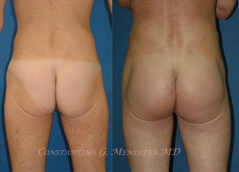 Before and After Image