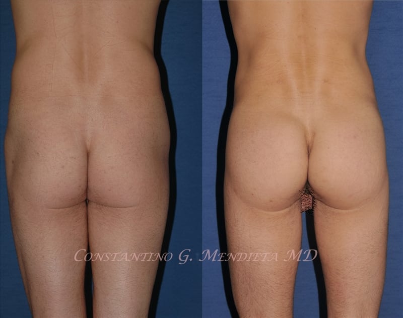 Before and After Image